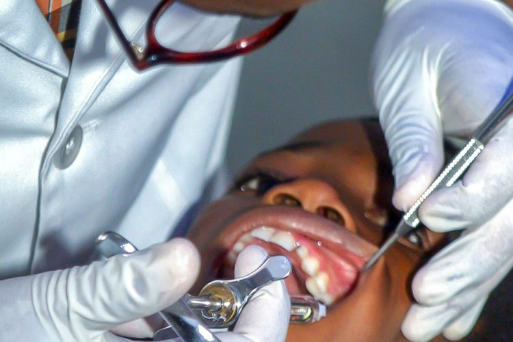 Painless Tooth Extraction